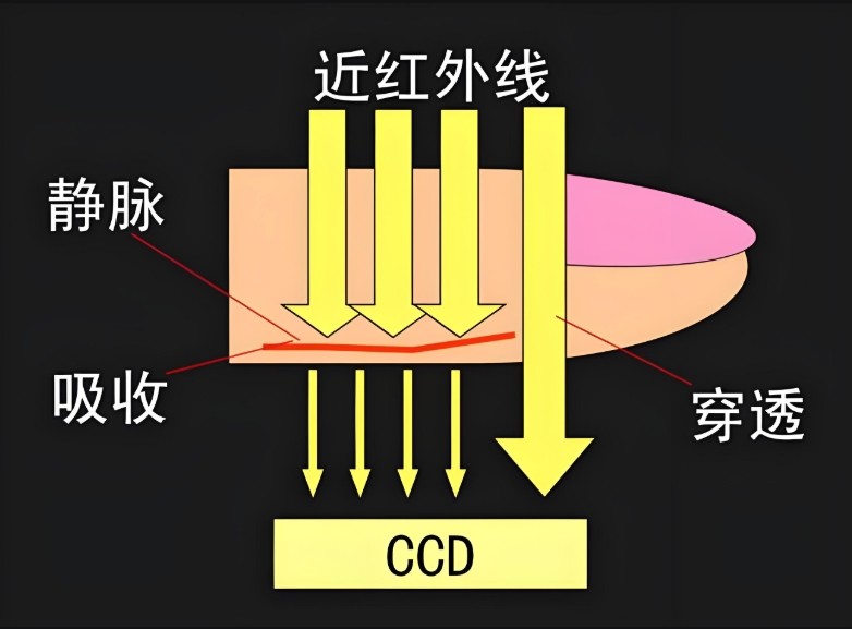 静脉显像仪原理